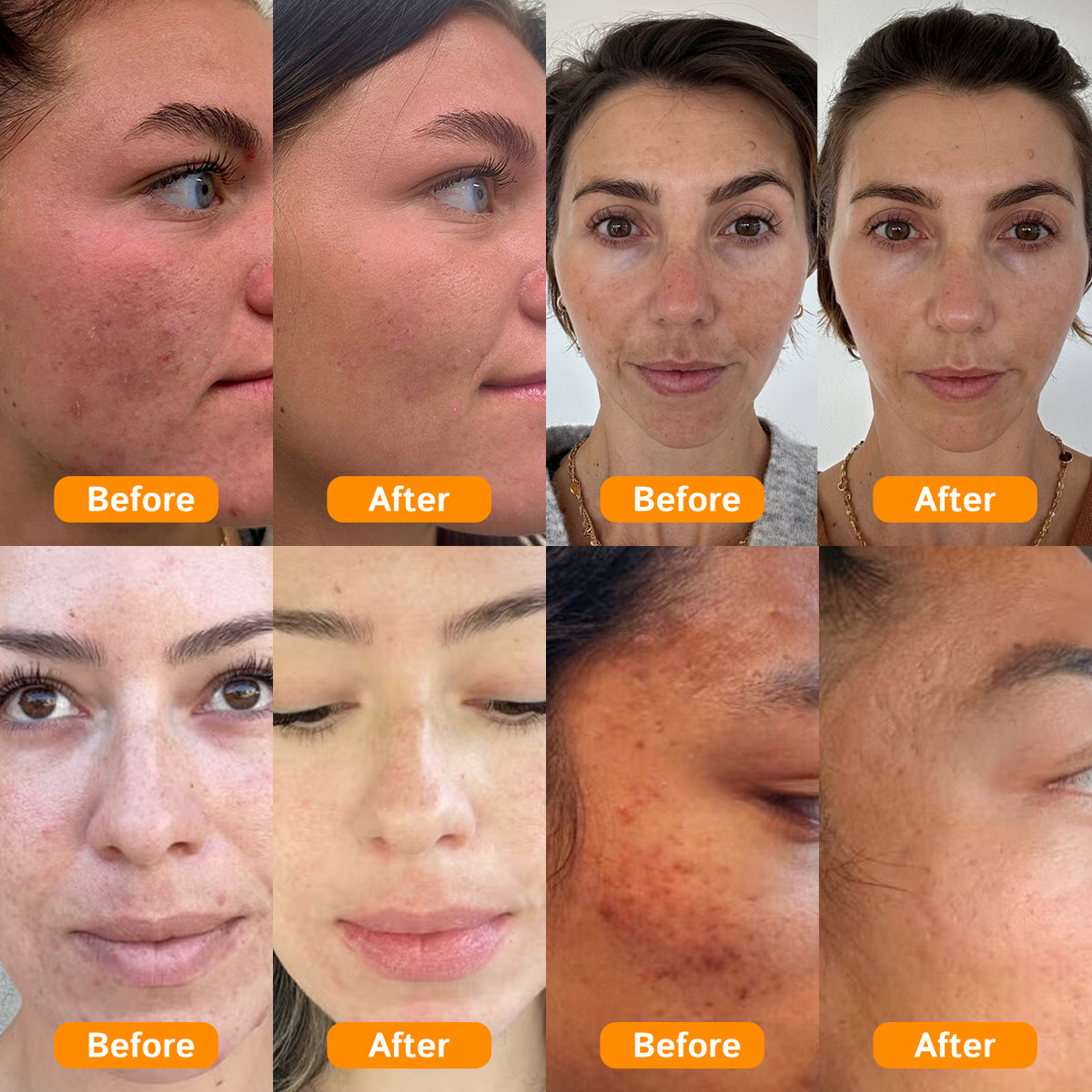 DermiPx